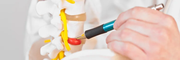 Bellingham WA Chiropractor Discusses Herniated Discs